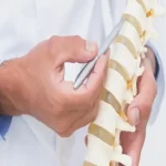 درمان دیسک گردن و تنگی کانال نخاعی