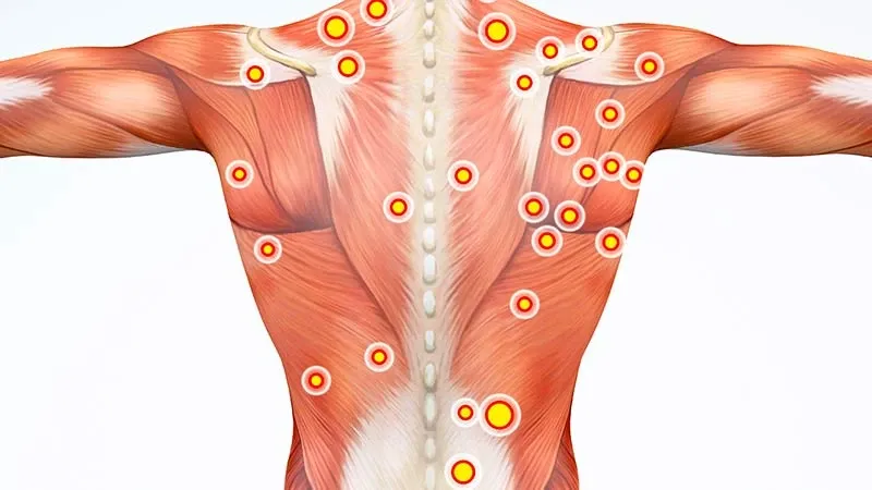 فیزیوتراپی شانه درد