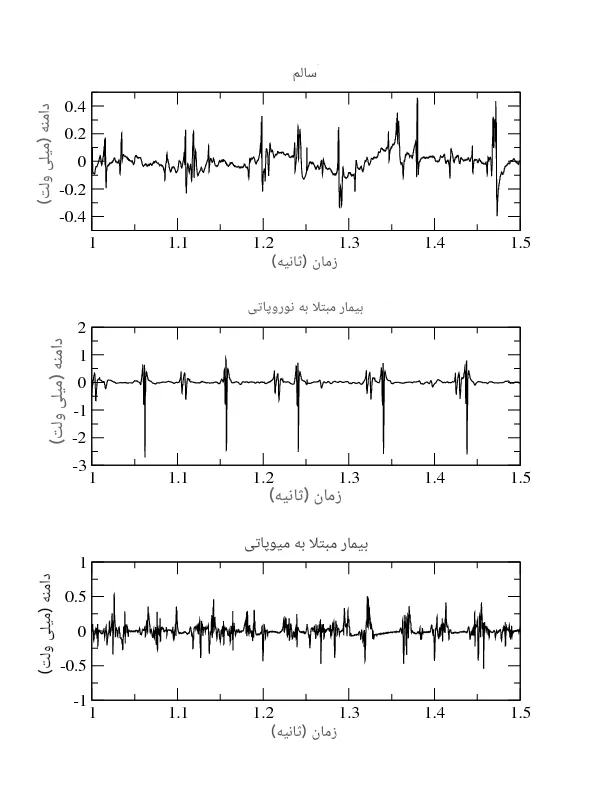 نوار عصب و عضله
