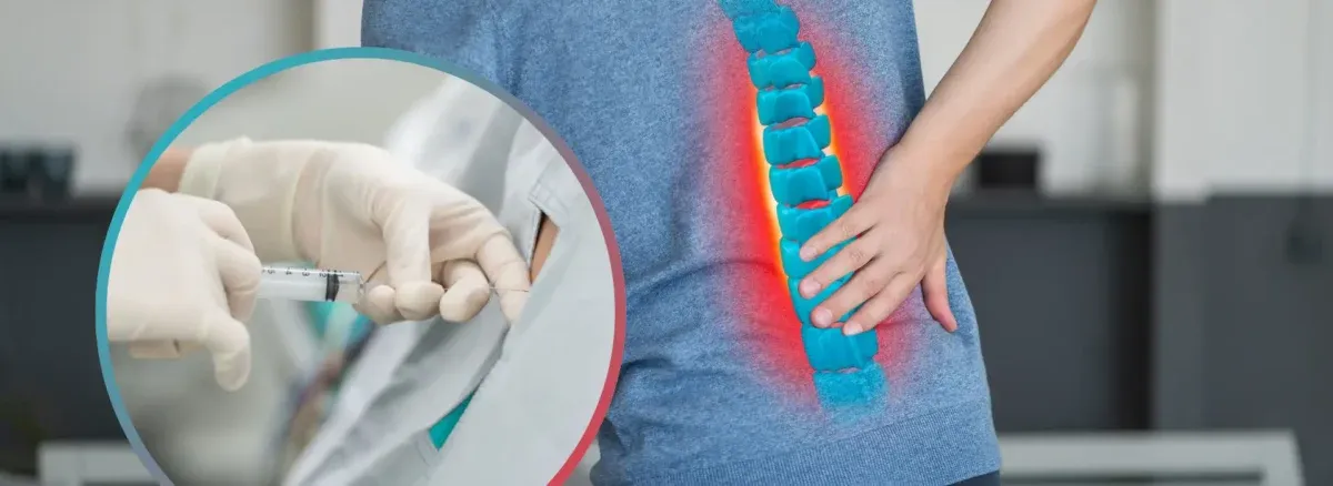 تزریقات درمانی برای دیسک کمر