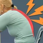 درمان قوز گردن با فیزیوتراپی