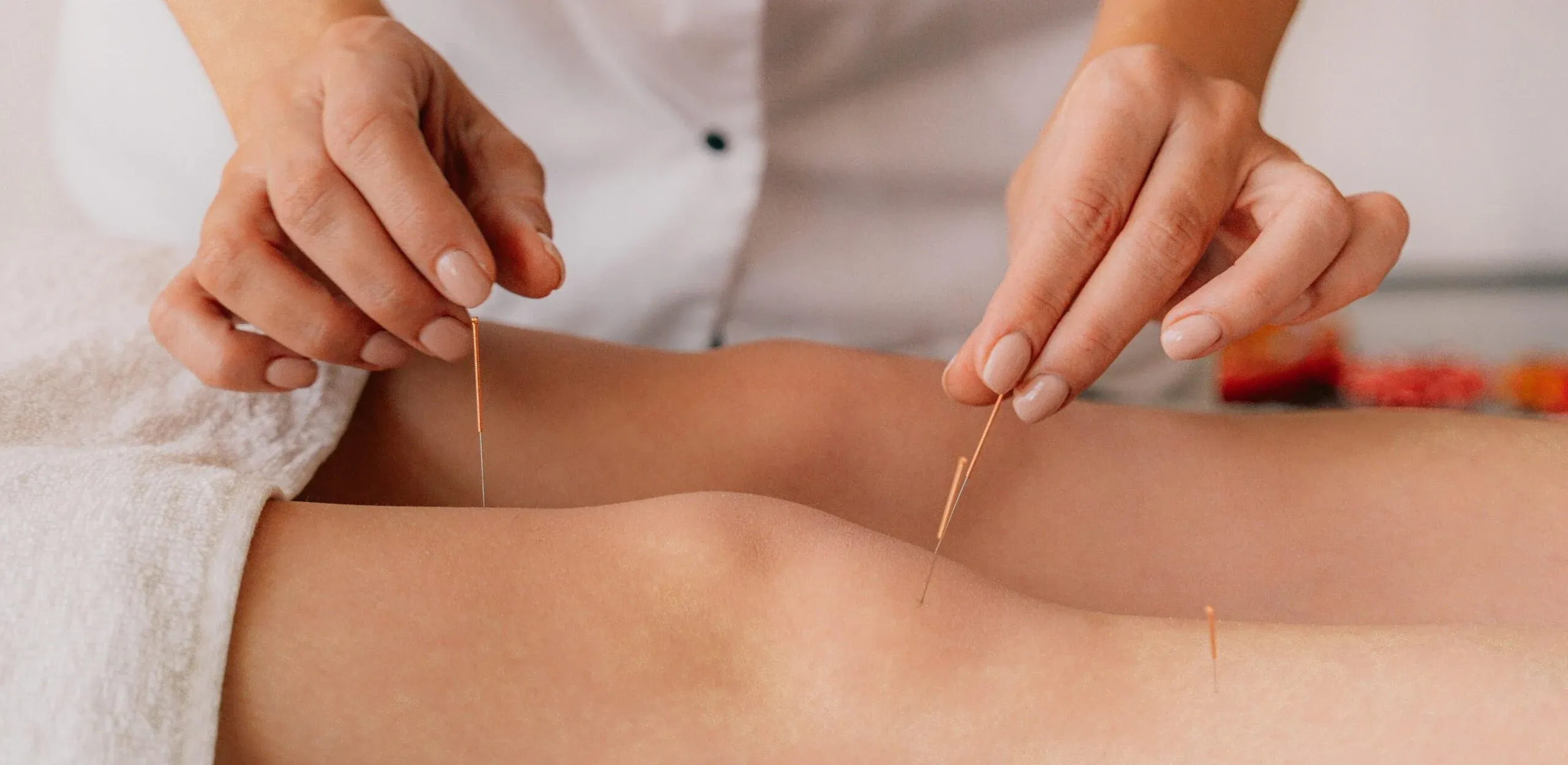 طب سوزنی برای درمان زانو درد و آرتروز