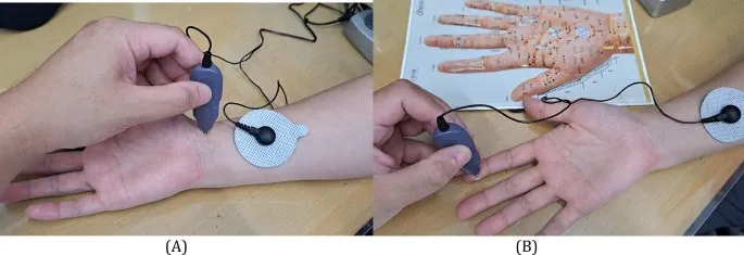 فیزیوتراپی انگشت ماشهای