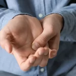 فیزیوتراپی انگشت ماشه‌ای