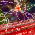 درمان بیماری نوروماسکولار